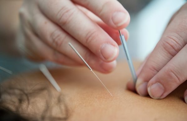 dunya-acupuncture-cairo